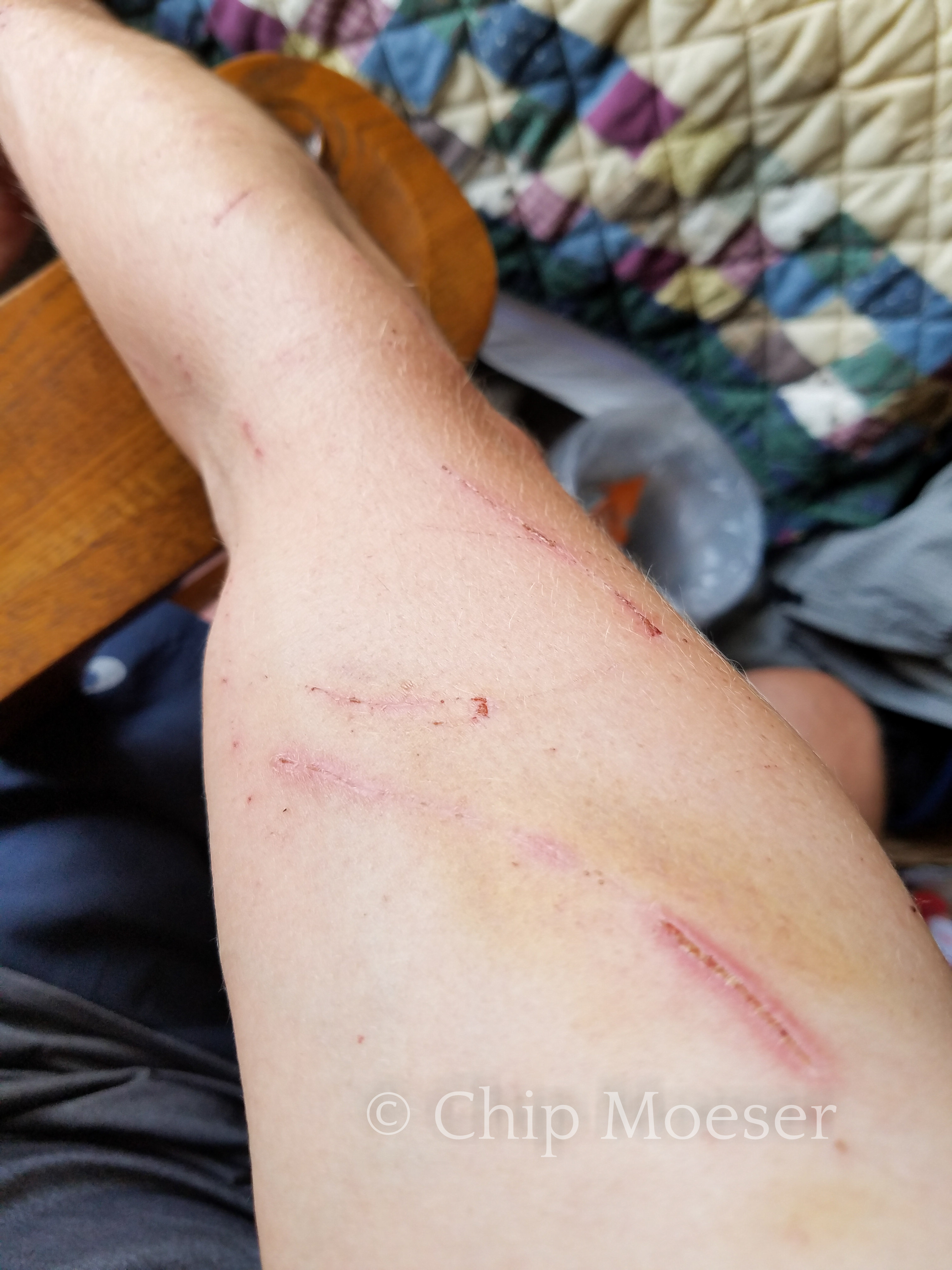 Bushwacking scars a few days later